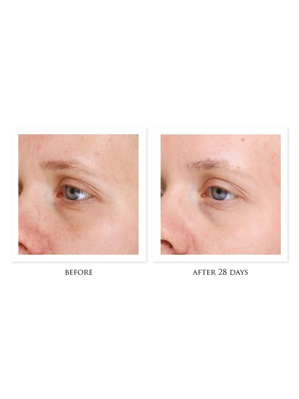 cosmedix_keep_clear_before_after_800x600_2.jpg