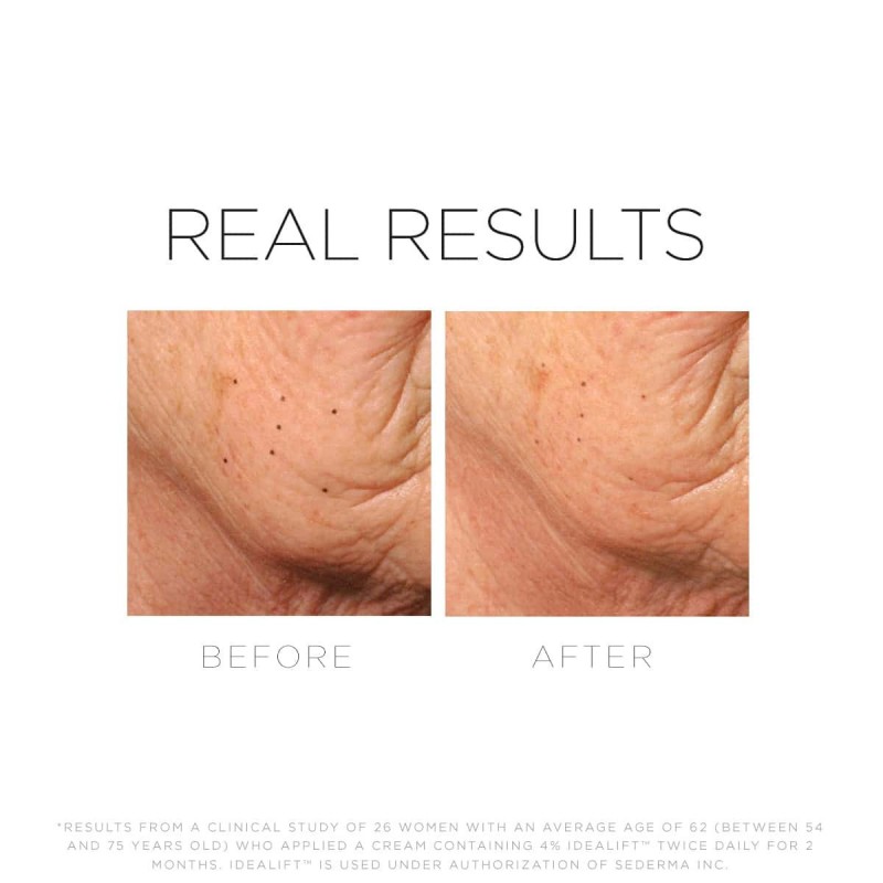 ukreplyayusshaya-anti-age-maska-cosmedix-bio-shape-anti-aging-mask-2