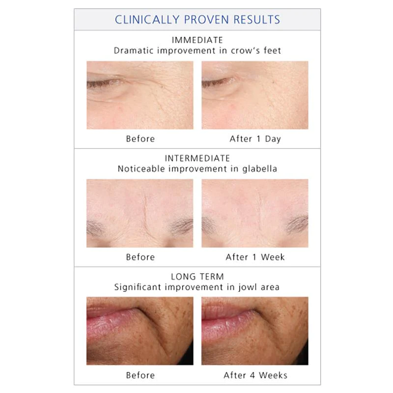 youth-intensive-creme-face-cream-is-clinical-229370_1400x.jpg