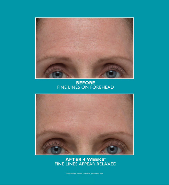 003822-2-amplified-wrinkle-fix-serum-crop-570x624-