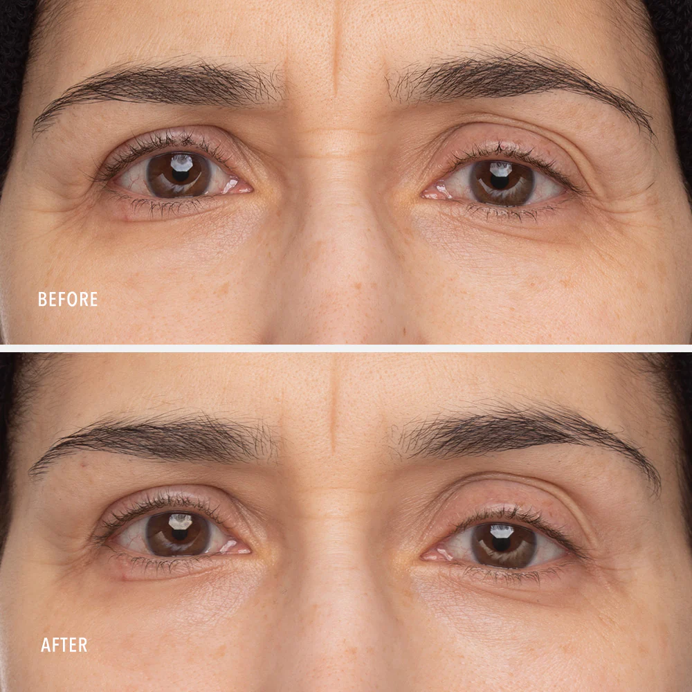 100124_B_As_Retinol-Eye-Renewal_PDP_4.jpg