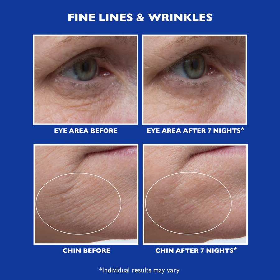 ALT4_Retinol_Serum_BandA_finelines_2000x2000_539b41d7-f0fa-4cbb-a241-48ee3e04882d.jpg