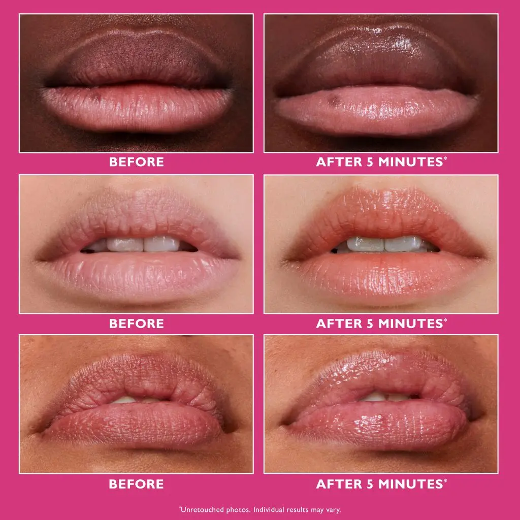 Instant FIRMx Lip Filler_BeforeAfter-1024x1024