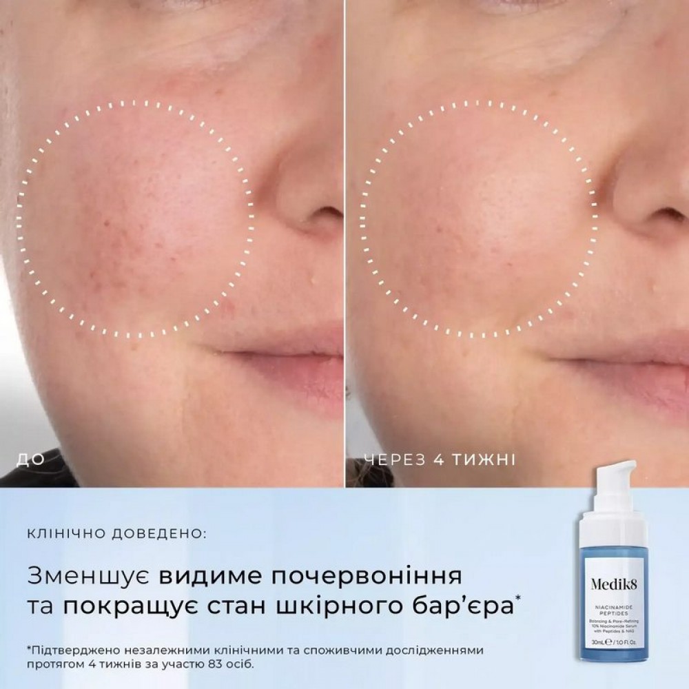 medik8-niacinamide-peptides-30-ml-peptidna-sirovatka-z-1000x1000